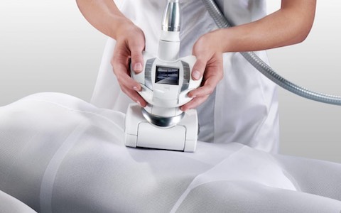 エンダモロジーendermologie